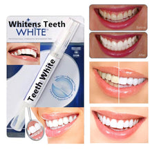 Load image into Gallery viewer, Home Teeth Whitener Kit